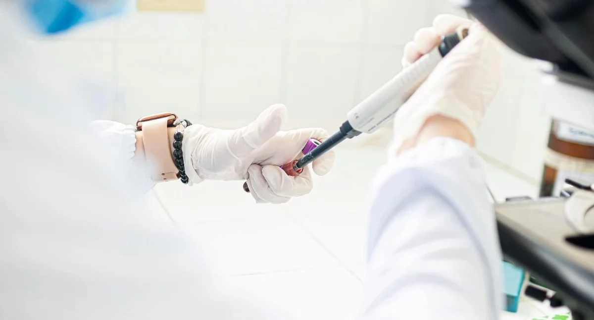 Koniec klasycznej cytologii w programie NFZ. Od 1 sierpnia rusza test HPV HR