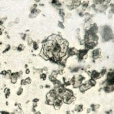 microphotograph_lead_white